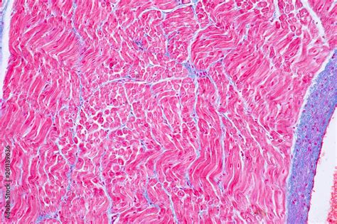 Histology Of Human Cardiac Muscle Under Microscope View For Education