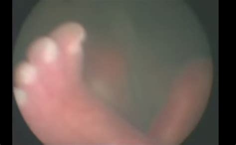El bebé a las 22 semanas de embarazo ya tiene pelo y cejas, pero aún se ven blancas por la falta de pigmentación. Esto no se ve todos los días: las increíbles imágenes de ...