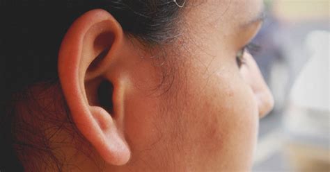 Smell Behind Ears Causes Symptoms And Treatments