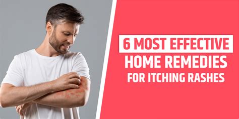6 Home Remedies For Itching Rashes Shuddhi Ayurveda