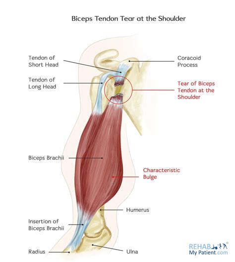 Biceps Tendon Anatomy