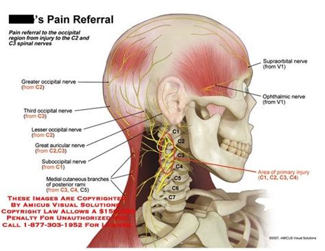 Occipital Nerve Nerve Pain Remedies Occipital Neuralgia Chronic