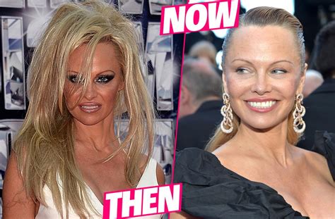 Pamela Andersons Plastic Surgery Makeover Exposed By Top Docs