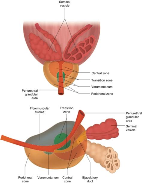 Transrectal Ultrasound Of The Prostate Radiology Key