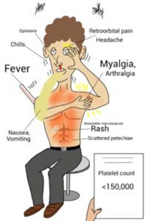 Dengue fever symptoms and signs include rash, fever, chills, fatigue, headache, and joint pain. Tracking dengue transmission in Thailand - BugBitten