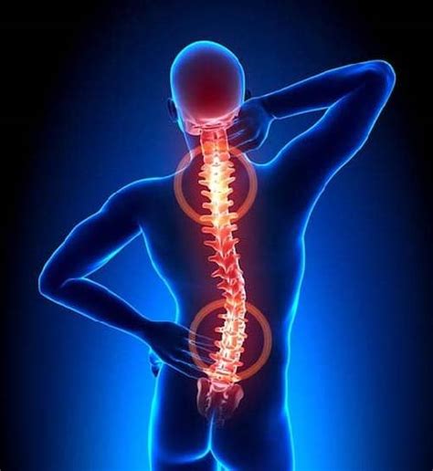 Spinal Arthritis And Disc Degeneration Treatment
