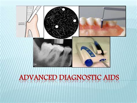 Advanced Diagnostic Aids In Periodontics Ppt