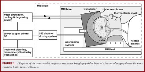 Pdf Transcranial Magnetic Resonance Imaging Guided Focused