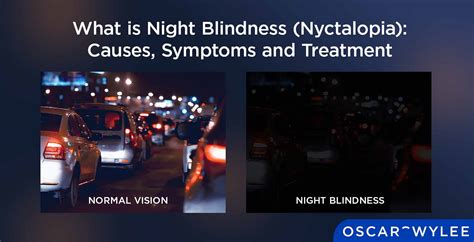 What Is Night Blindness Nyctalopia Causes Symptoms And Treatment