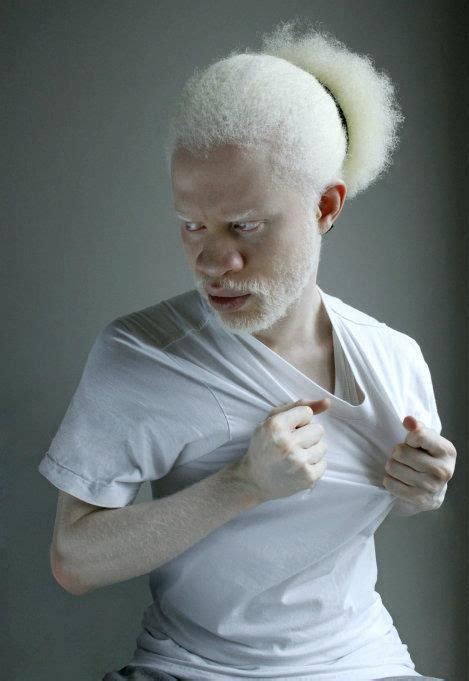 Hotguysilike Deejay Jewell Tausendsassa Interesting Faces Albino Men Unique Faces