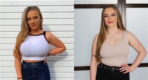 Babe Has Breast Reduction Op After She Was Warned Her J Breasts Could Crush Her Spine