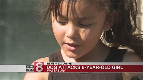 6 Year Old Girl Attacked By Pit Bull Youtube