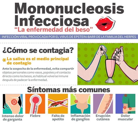 Resumen de artículos como se contagia la mononucleosis actualizado recientemente sp