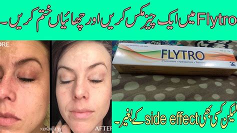 Remove freckles & melasma on face with hyderquin plus & flytro cream urdu hindi. Flytro Cream Remove Freckles Melasma On Face.Mahnoor ...