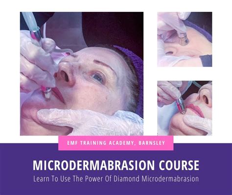 Microdermabrasion Facial Course 10am 4pm Emf Training Ltd