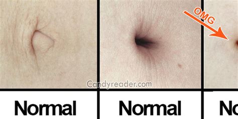 Omg 10 Bizarre Facts About Belly Button You Cannot Even Imagine