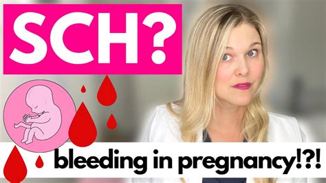 Bleeding In Pregnancy What Is A Subchorionic Hematoma Youtube