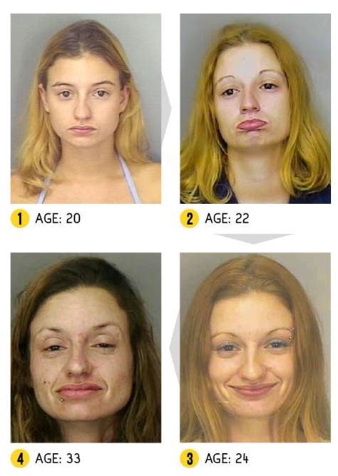 Crystal Meth Addicts Before And After Pics With Mugshots Flesh Eating Drugs On The Street Hot