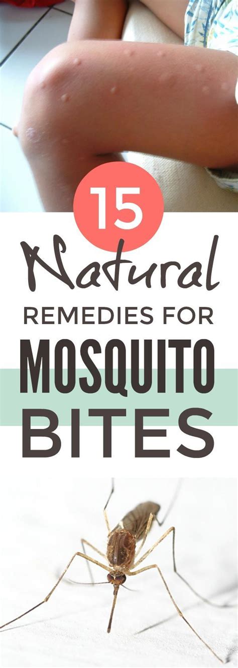 Diy Mosquito Bite Remedies Remedies For Mosquito Bites Natural