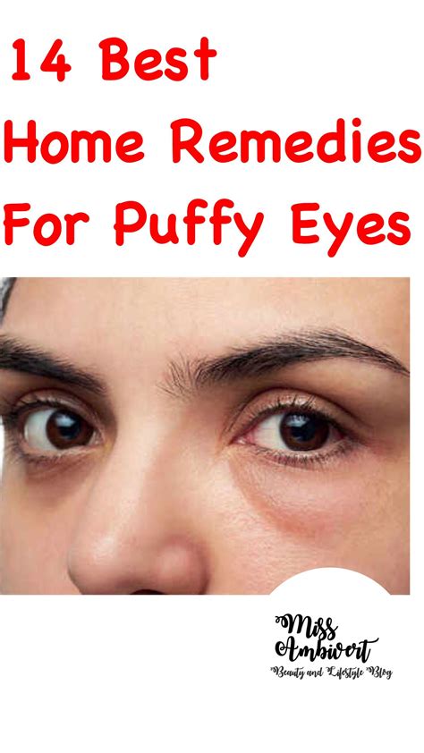 Puffy Eyes Fix Exactly How To Obtain Rid Root Causes Of Symptoms And