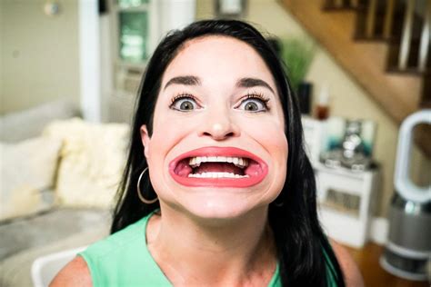 Tiktok Star Sets Guinness Record For Worlds Largest Mouth Its