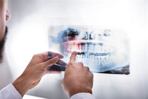 Oral Cancer Screening Wyndham Dental Solutions