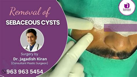 Sebaceous Cyst Treatment Sebaceous Cyst Removal Surgery In Hyderabad