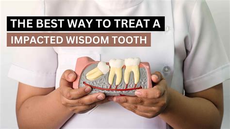 The Best Way To Treat An Impacted Wisdom Tooth