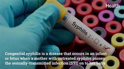 Congenital Syphilis Rates Are The Highest Theyve Been In More Than 20