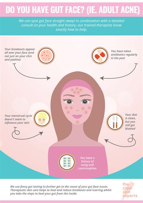 How To Tell If You Have Gut Face Acne Clear Skin Experts
