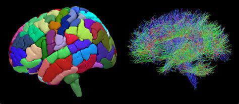 Improving Epilepsy Surgery New Research Reveals How Brains Are Wired