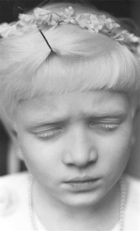 Marieaunet Richard Ofarrell Portrait Of A Blind Albino Girl From Mumbai