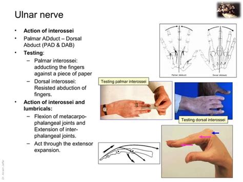 Applied Anatomy Ulnar Nerve Injury