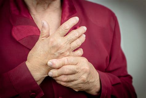 Rheumatoid Arthritis The Stages Signs And Treatment