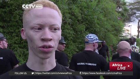Kenya Fights Deadly Stigma With Albino Beauty Pageant Youtube