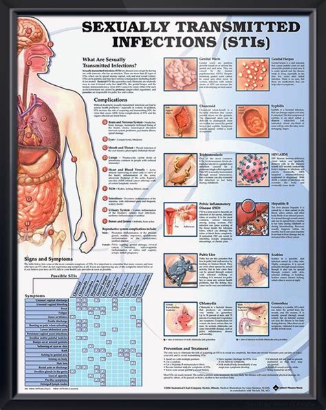 Sexually Transmitted Infections Anatomy Poster For Medical Office And Classroom Medical