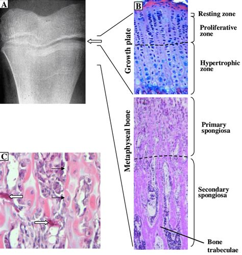 Long Bone Labeled Epiphyseal Plate Structure Of Bones