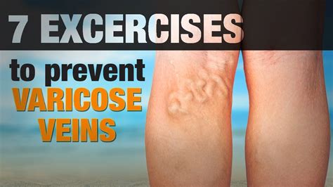 7 Exercises For Varicose Veins Move With Cassy Youtube