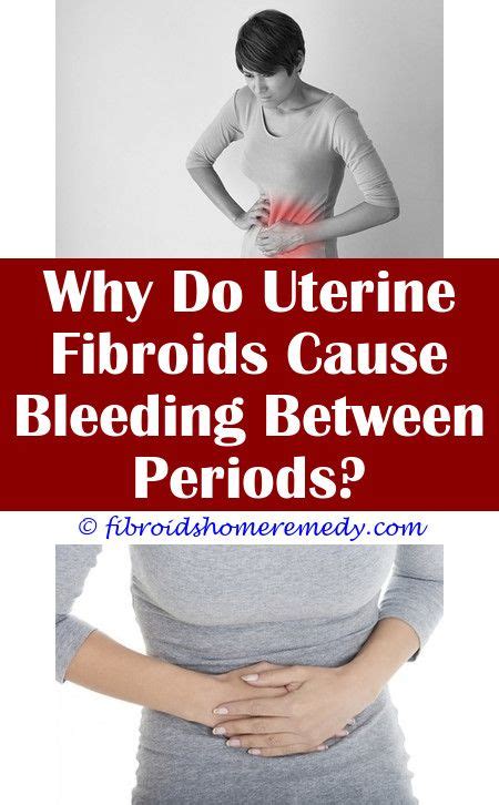 Getting Pregnant With Intramural Fibroids Uterine Fibroids Fibroids