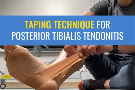 Taping For Posterior Tibial Tendonitis
