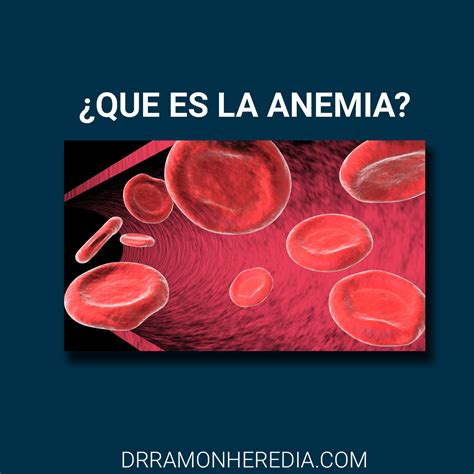 Que Es La Anemia Sintomas Causas Y Tratamiento