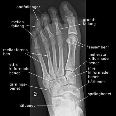 To download this image, create an account. 8 best Foot x ray images on Pinterest | Human anatomy ...