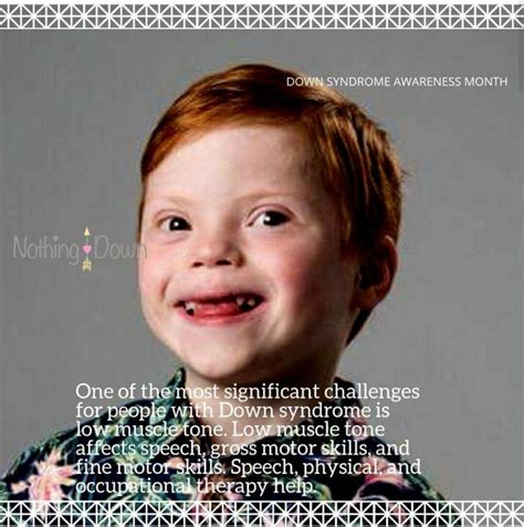 Nothing Down Low Muscle Tone Down Syndrome Awareness Month Down