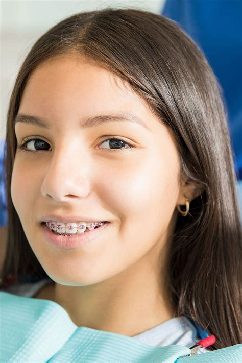 Corrective Braces Have Been Around For Decades And They Remain One Of The Most Effective Ways