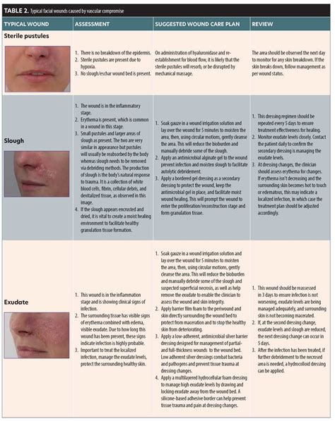 Facial Vascular Events And Tissue Ischemia A Guide To Understanding