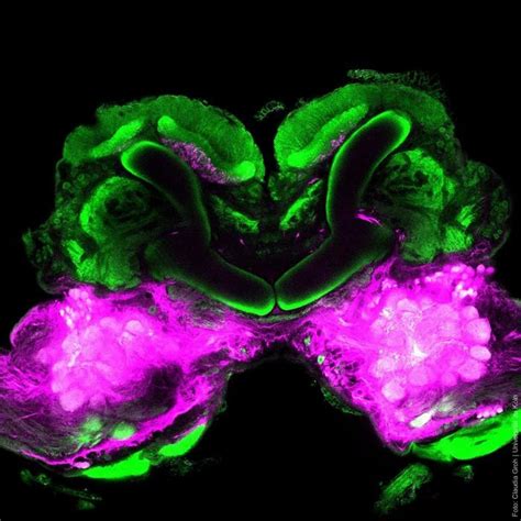 Cockroach Brain With Mushroom Image Eurekalert Science News Releases