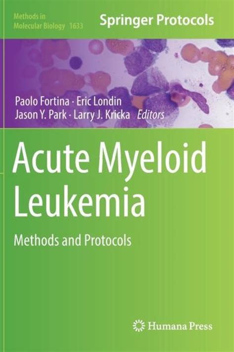 Acute Myeloid Leukemia 9781493971404 Boeken
