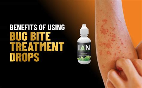 Benefits Of Using Bug Bite Treatment Drops Ion Oxygen