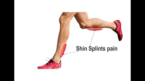 Shin Splints Prevention Exercises Youtube