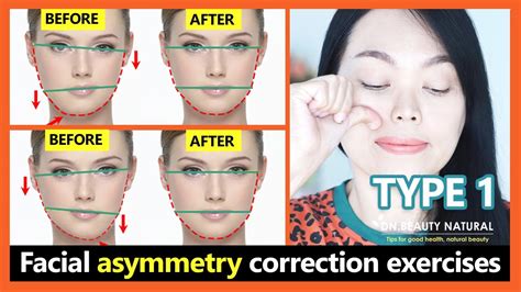 Type 1 How To Fix Asymmetrical Face Get A Symmetrical Face Naturally